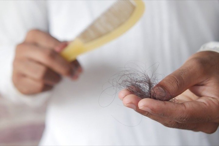 बाल झड़ना